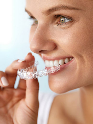 clear aligners